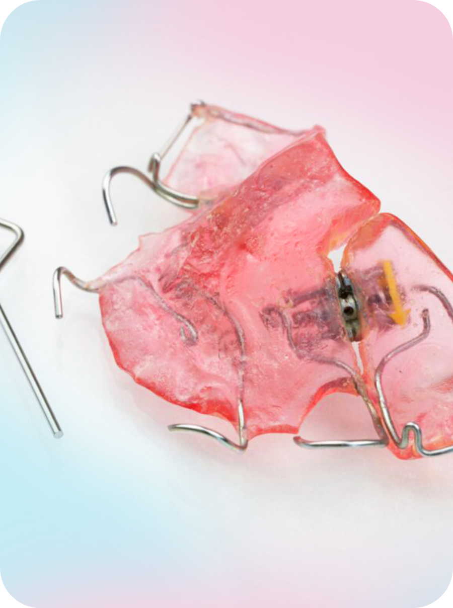 ワイヤー付きの床矯正装置の写真