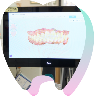 歯の模型とレントゲンを表示している画像