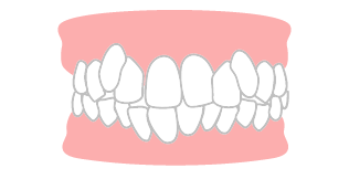 叢生のイラスト