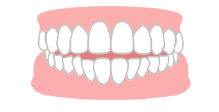 開咬のイラスト