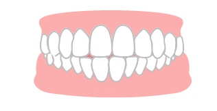 交又咬合のイラスト