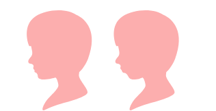 アデノイド顔貌のイラスト